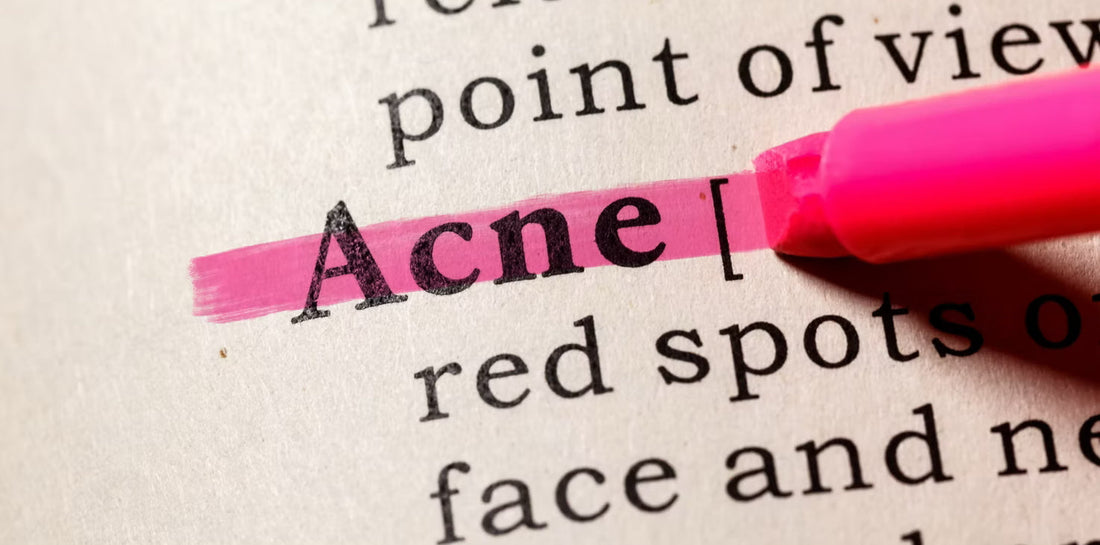 Milde Wirkstoffe gegen Akne & unreine Haut: Warum sanfte Pflege oft wirksamer ist als aggressive Mittel