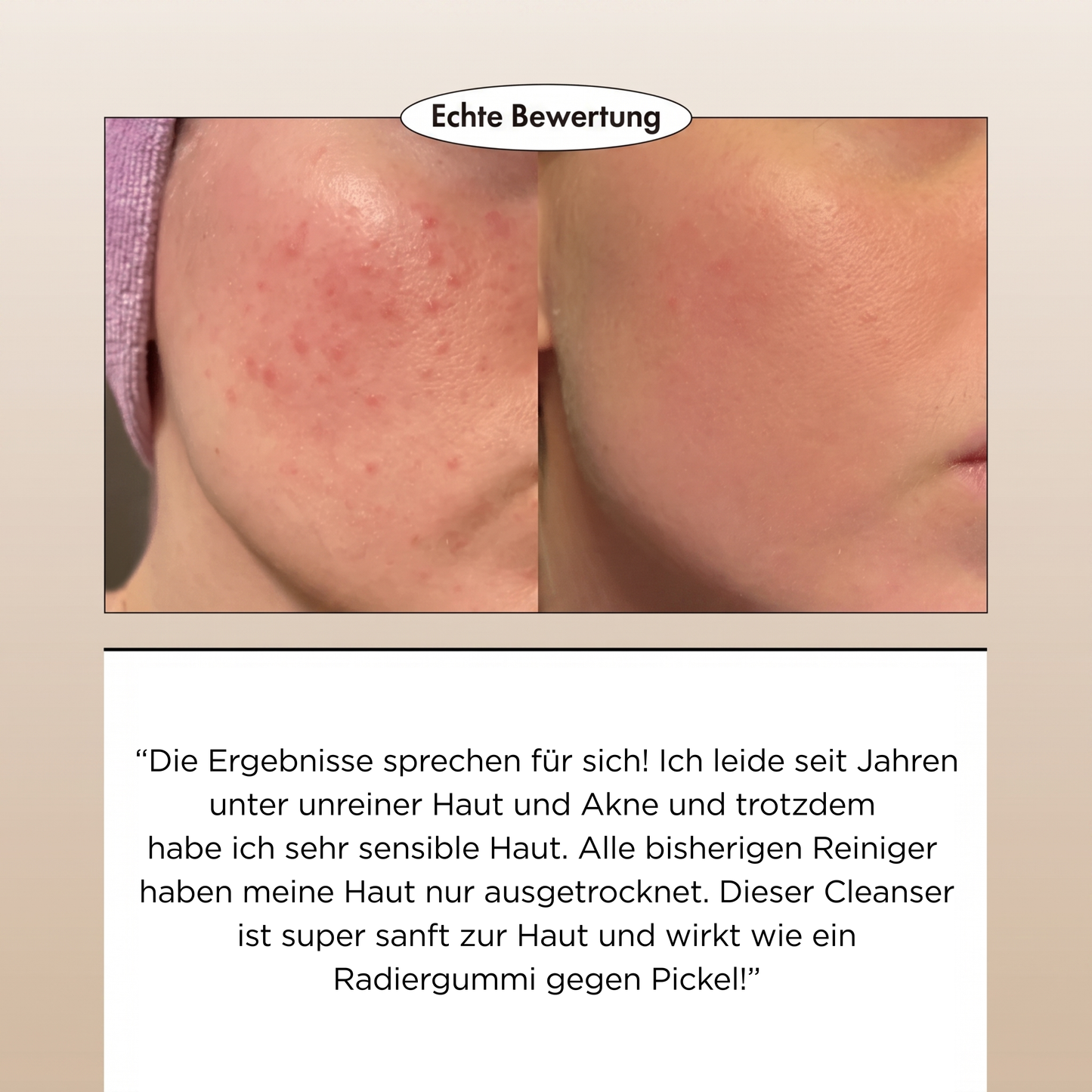 Microbiome AC Deep Pore Gel Cleanser